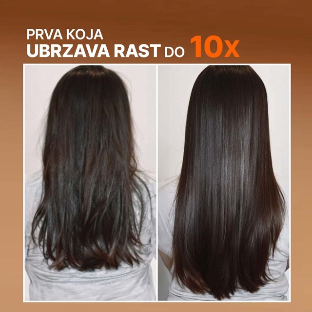 MORINGA---SLAJD---prije-poslije