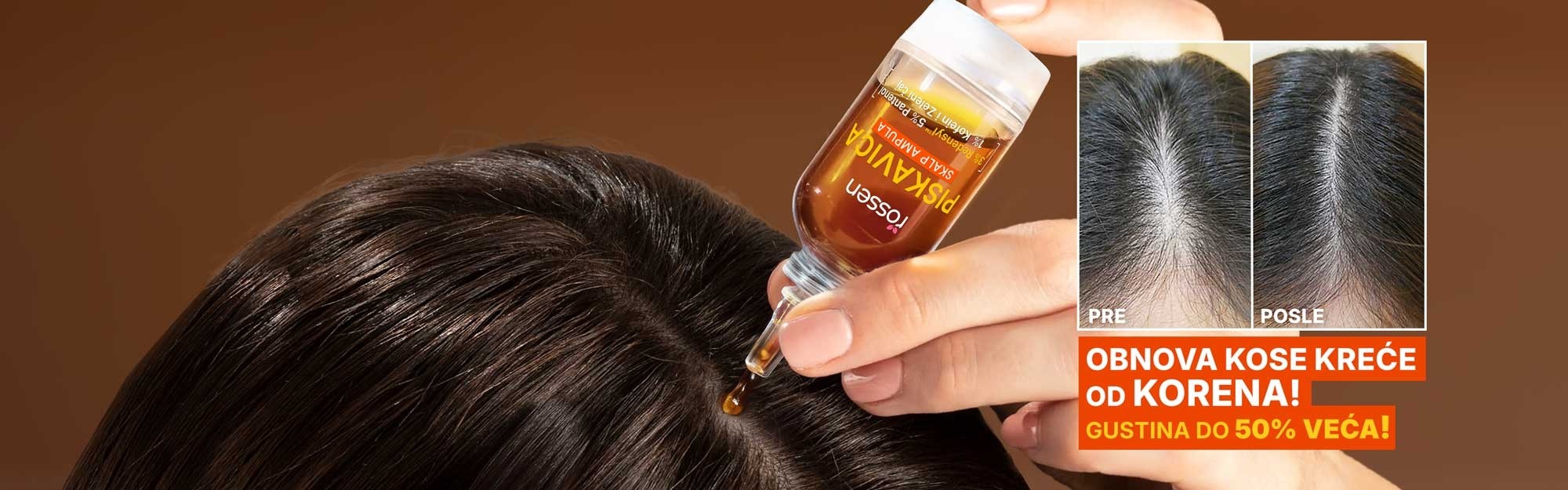 puskavica-serum---sekcija-1---SRBS