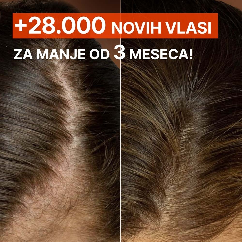 SLAJD-7----PRIJE-POSLIJE