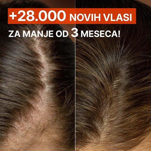 SLAJD-7----PRIJE-POSLIJE