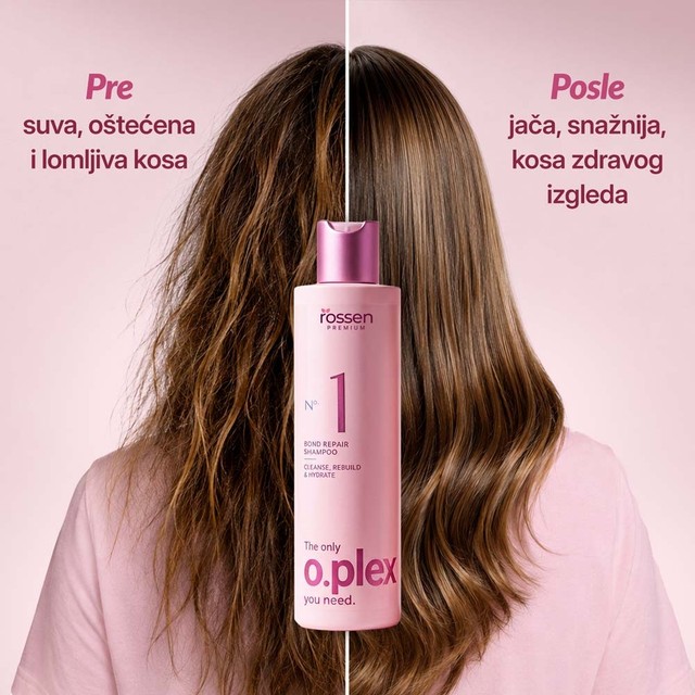 KOSA-PRIJE-I-POSLIJE---SRB